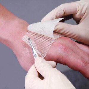Chlorhexidine Gauze Dressing