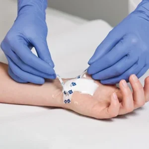 Super Absorbent & Transparent Film Dressings